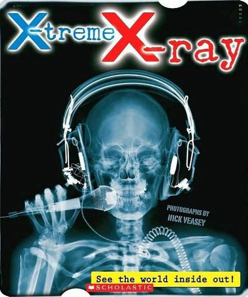 X-treme X-ray: See The World Inside Out!