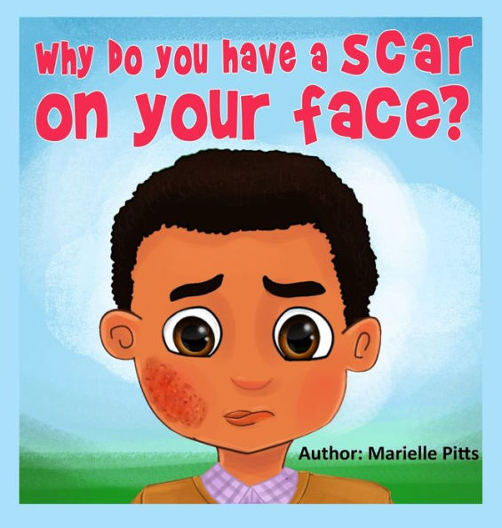 Why do you have a scar on your face?