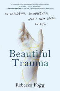 Public domain ebooks download Beautiful Trauma: An Explosion, an Obsession, and a New Lease on Life iBook