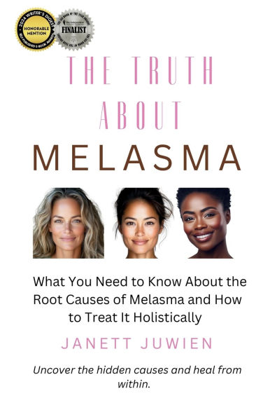 The Truth About Melasma: What You Need to Know About the Root Causes of Melasma and How to Treat It Holistically