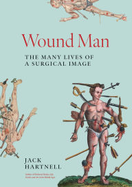 Title: Wound Man: The Many Lives of a Surgical Image, Author: Jack Hartnell