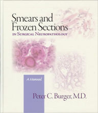 Title: Smears and Frozen Sections in Surgical Neuropathology: A manual, Author: Peter Burger