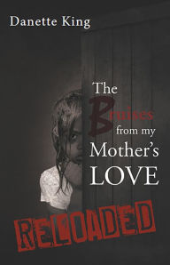 Title: The Bruises from my Mother's Love, Author: Danette King