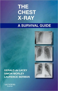 Title: The Chest X-Ray: A Survival Guide, Author: Gerald de Lacey MA