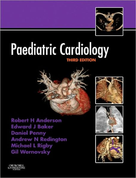 Paediatric Cardiology: Expert Consult - Online and Print / Edition 3