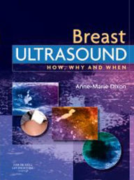 Title: E-Book - Breast Ultrasound: E-Book - Breast Ultrasound, Author: Anne-Marie Dixon MHSc