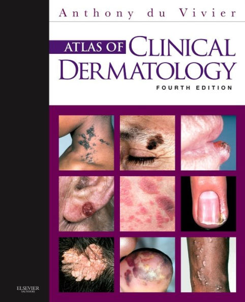 Atlas of Clinical Dermatology / Edition 4