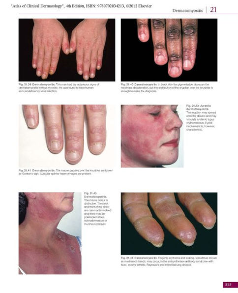 Atlas of Clinical Dermatology / Edition 4