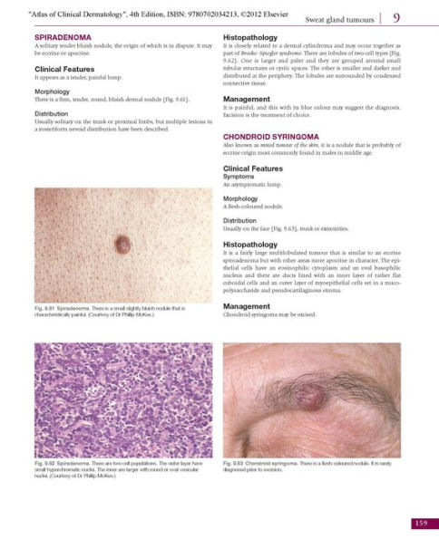 Atlas of Clinical Dermatology / Edition 4