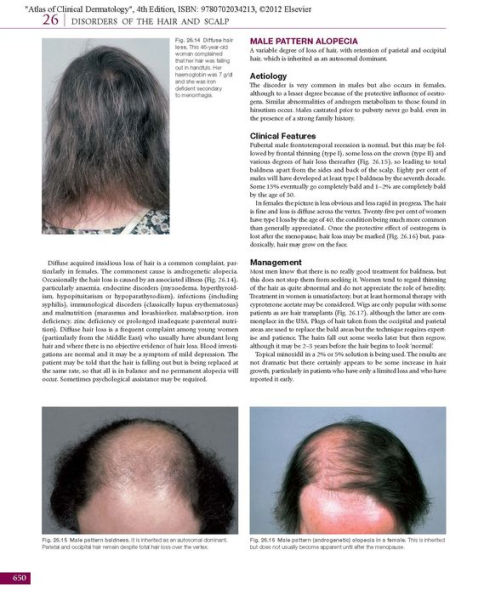 Atlas of Clinical Dermatology / Edition 4