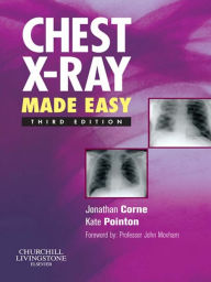 Title: Chest X-Ray Made Easy E-Book, Author: Jonathan Corne