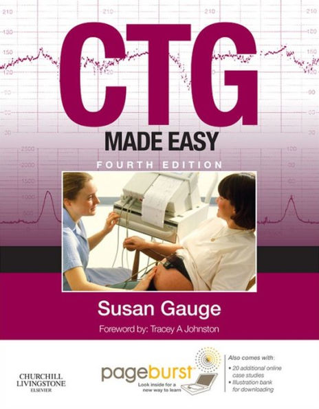 CTG Made Easy E-Book: CTG Made Easy E-Book