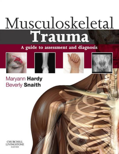 Musculoskeletal Trauma E-Book: Musculoskeletal Trauma E-Book