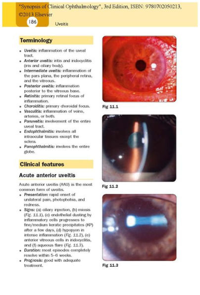 Synopsis of Clinical Ophthalmology: Expert Consult - Online and Print / Edition 3