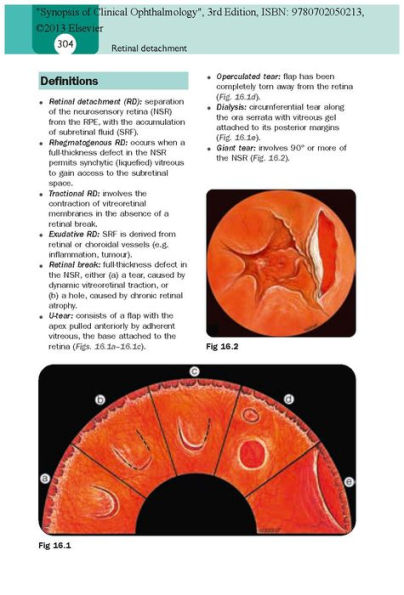 Synopsis of Clinical Ophthalmology: Expert Consult - Online and Print / Edition 3