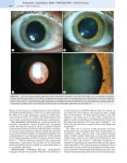 Alternative view 4 of Glaucoma: 2-Volume Set / Edition 2