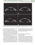 Alternative view 5 of Glaucoma: 2-Volume Set / Edition 2