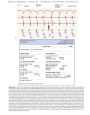 Alternative view 4 of Miller's Anesthesia, 2-Volume Set / Edition 8