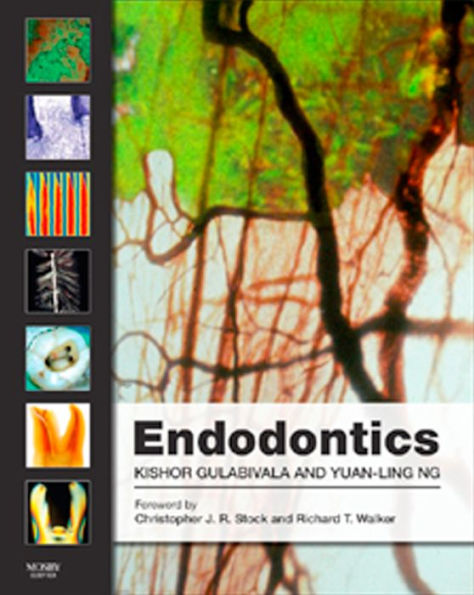 Endodontics E-Book: Endodontics E-Book