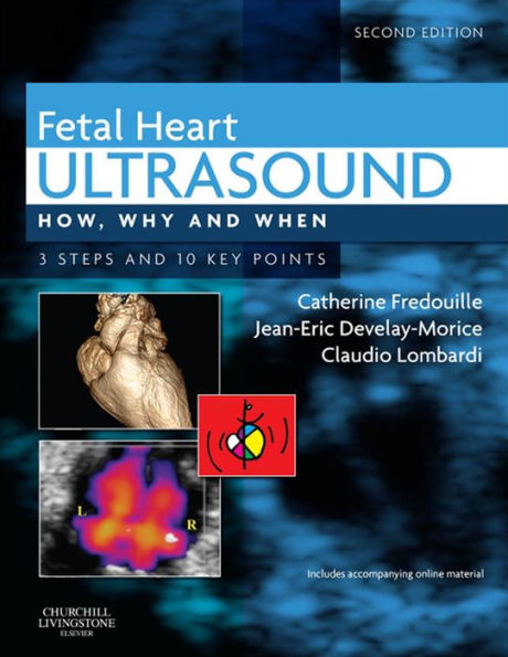 Fetal Heart Ultrasound - E-Book: Fetal Heart Ultrasound - E-Book