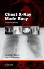 Chest X-Ray Made Easy: Chest X-Ray Made Easy E-Book