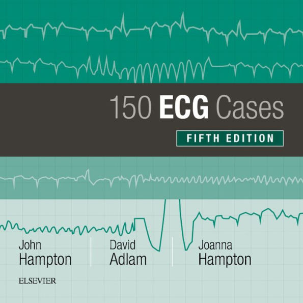 150 ECG Cases