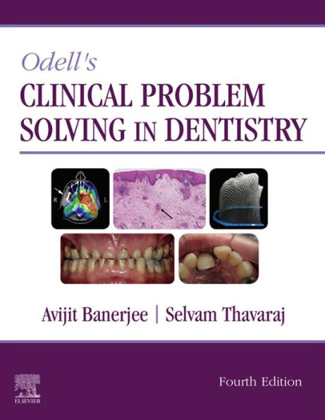 Odell's Clinical Problem Solving in Dentistry E-Book: Odell's Clinical Problem Solving in Dentistry E-Book