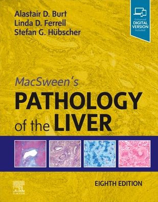 MacSween's Pathology of the Liver