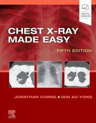 Title: Chest X-Ray Made Easy, Author: Jonathan Corne MA