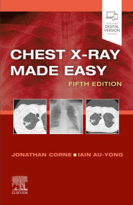 Title: Chest X-Ray Made Easy E-Book: Chest X-Ray Made Easy E-Book, Author: Jonathan Corne MA