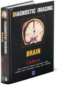 Free e books kindle download Diagnostic Imaging: Brain 9780323377546 MOBI