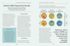 Alternative view 12 of Brain: An Owner's Guide