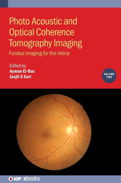 Photo Acoustic and Optical Coherence Tomography Imaging: Fundus Imaging for the Retina