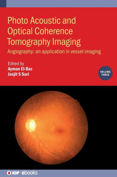 Photo Acoustic and Optical Coherence Tomography Imaging: Angiography: - An Application Vessel Imaging
