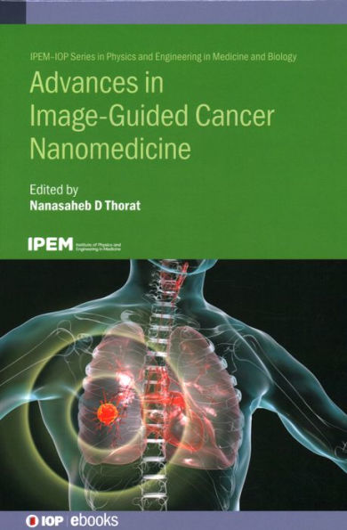 Advances Image Guided Cancer Nanomedicine