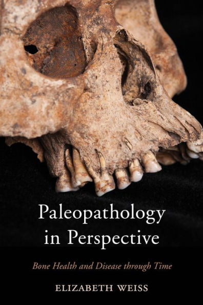 Paleopathology Perspective: Bone Health and Disease through Time