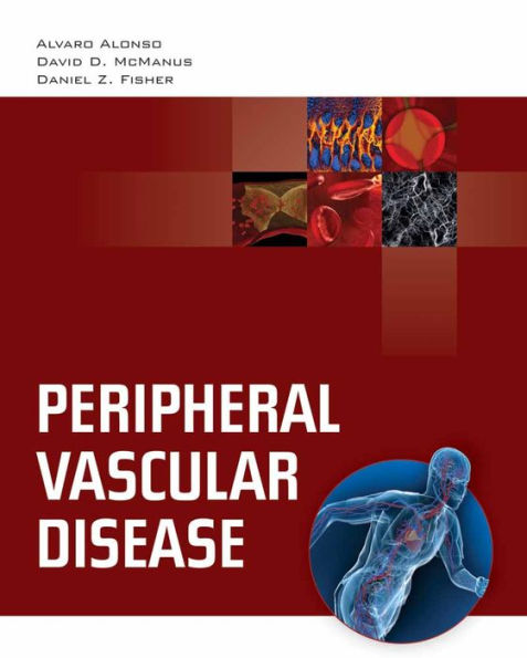 Peripheral Vascular Disease / Edition 1