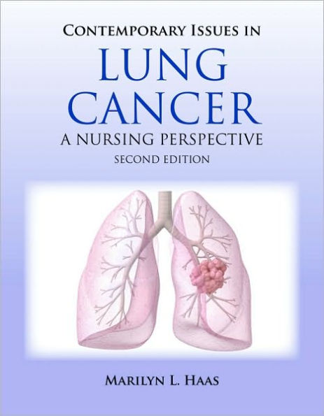 Contemporary Issues in Lung Cancer / Edition 2