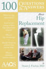 100 Questions & Answers About Hip Replacement