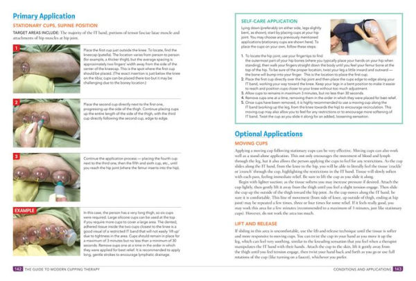 The Guide to Modern Cupping Therapy: Your Step-by-Step Source for Vacuum Therapy