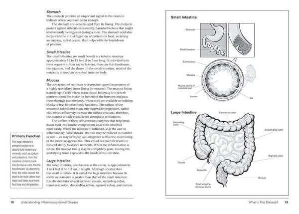 Crohn's and Colitis: Understanding and Managing IBD