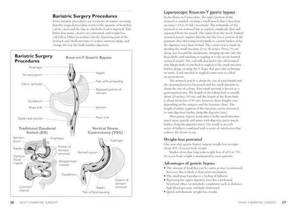 The Complete Bariatric Surgery Guide and Diet Program: Includes 150 Recipes for Lifelong Weight-Loss Success