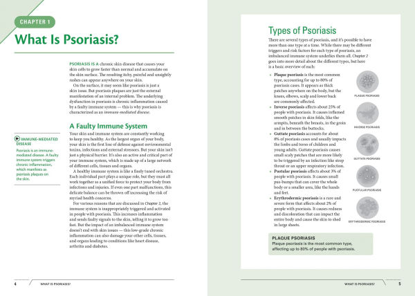 The Holistic Psoriasis Management and Nutrition Guide: Natural Solutions to Treat and Relieve Your Symptoms