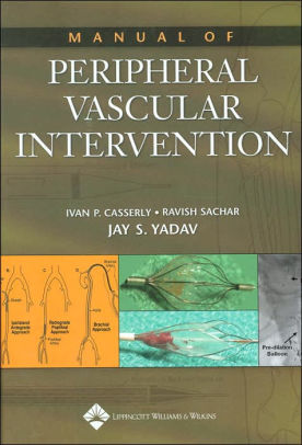 Guide to Peripheral and Cerebrovascular Intervention