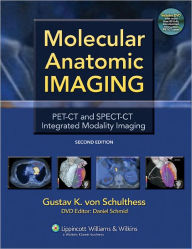 Title: Molecular Anatomic Imaging: PET-CT and SPECT-CT Integrated Modality Imaging / Edition 2, Author: Gustav K. von Schulthess