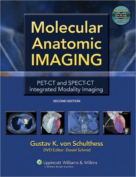 Molecular Anatomic Imaging: PET-CT and SPECT-CT Integrated Modality Imaging / Edition 2