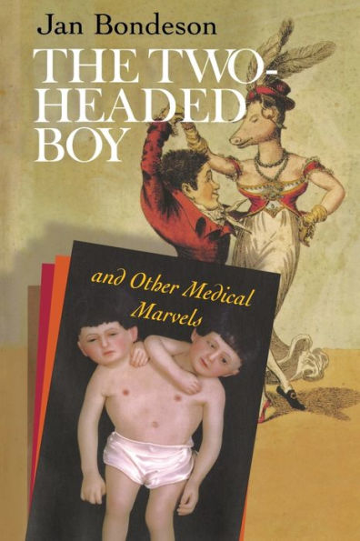 The Two-headed Boy, and Other Medical Marvels / Edition 1
