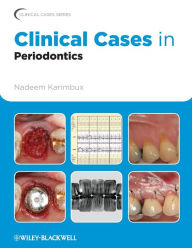 Title: Clinical Cases in Periodontics / Edition 1, Author: Nadeem Karimbux