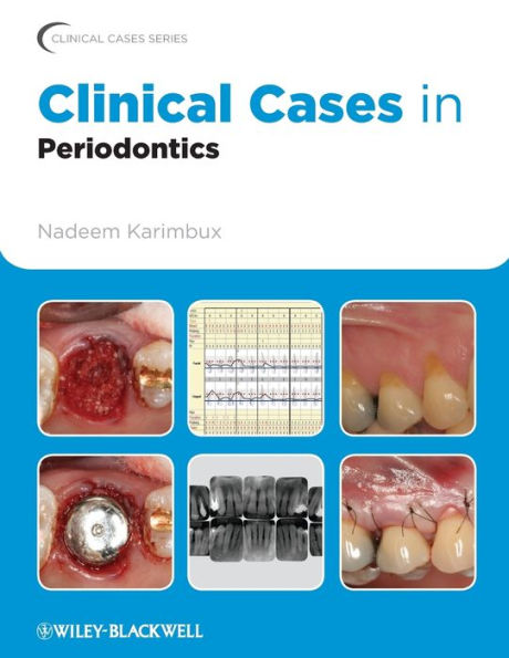 Clinical Cases in Periodontics