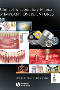 Title: Clinical and Laboratory Manual of Implant Overdentures / Edition 1, Author: Hamid R. Shafie